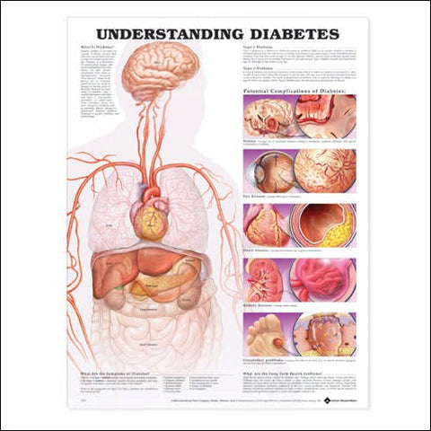 Understanding Diabetes(Poster Size)